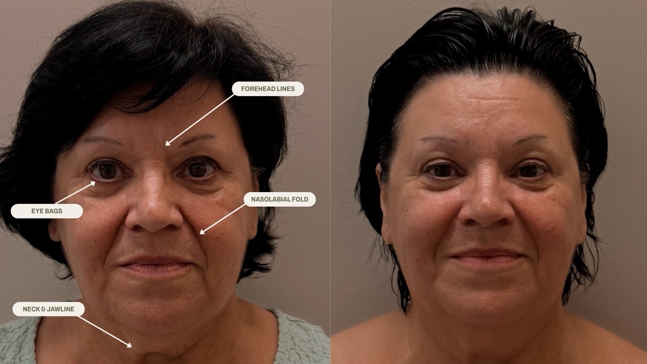 What Makes Face Sculpting Massage Unique?