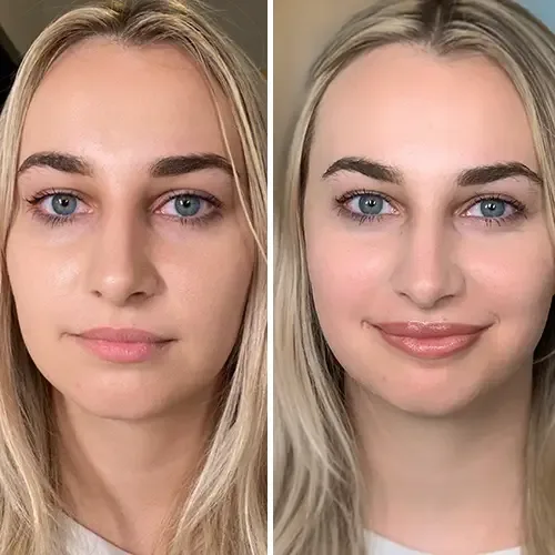 Before and after lip blushing at ANNAZUR Organic Beauty Spa, Jacksonville FL — photo 6