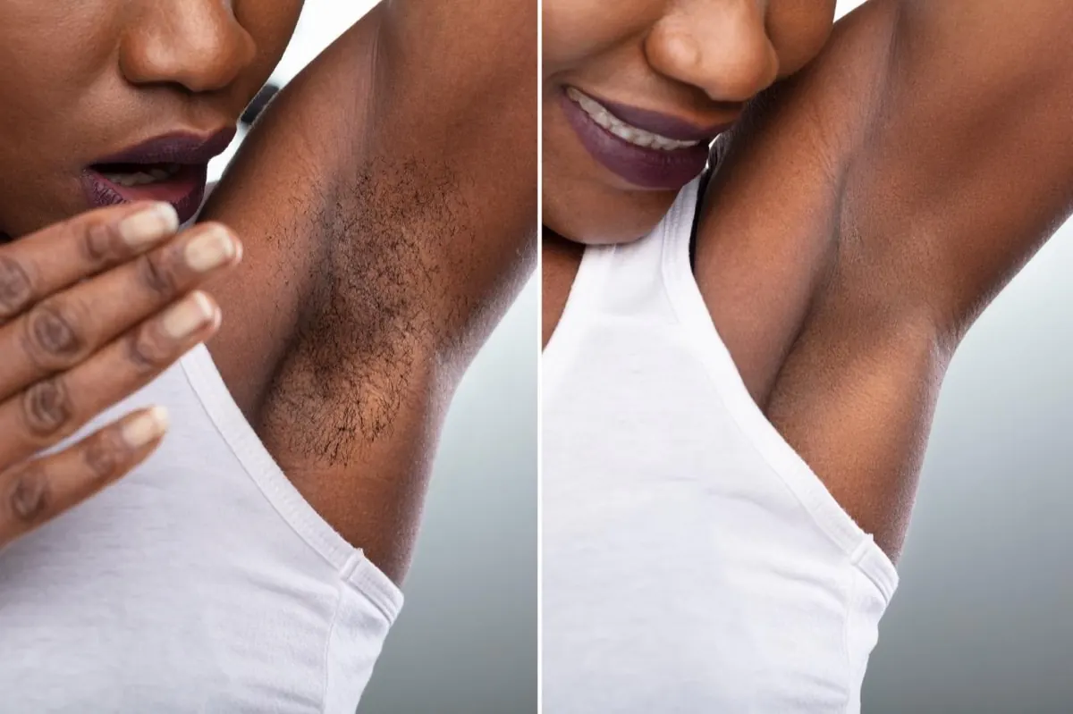 Underarm hair-removal before-and-after comparison