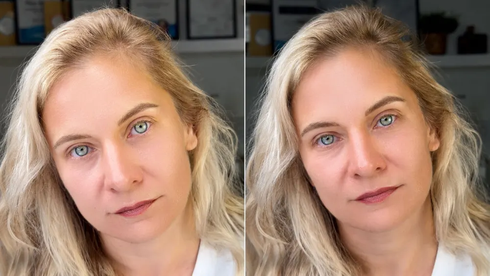 Before and after