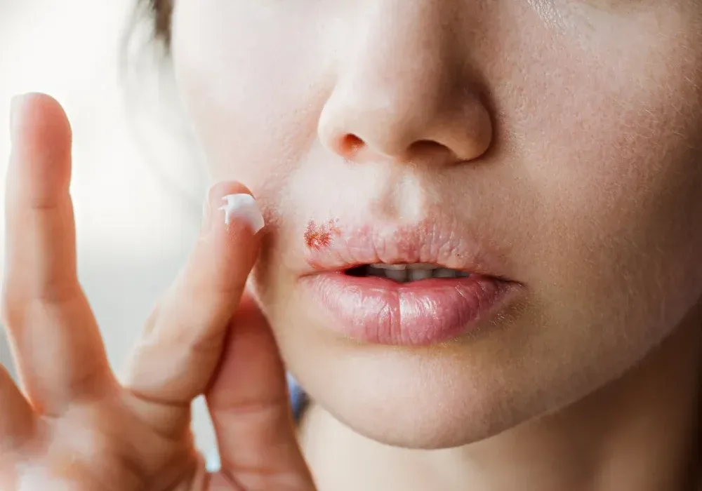 Client applies specialized ointment with fingers during wet healing lip tattoo aftercare routine
