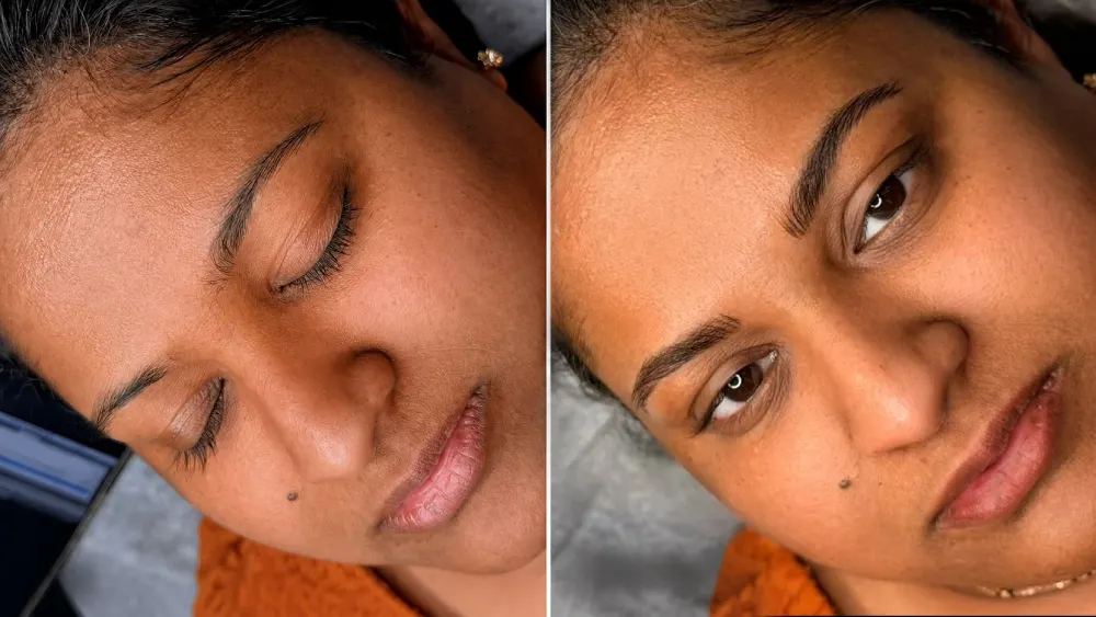 Before and after