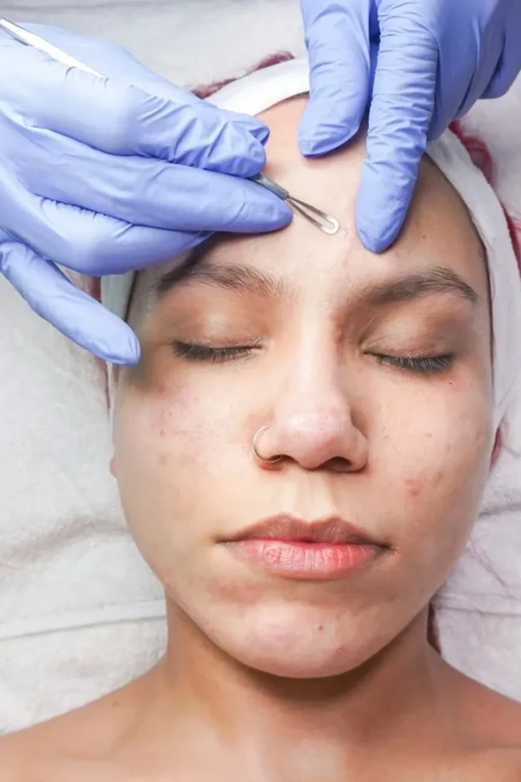 Preparation, and the skin you should turn away