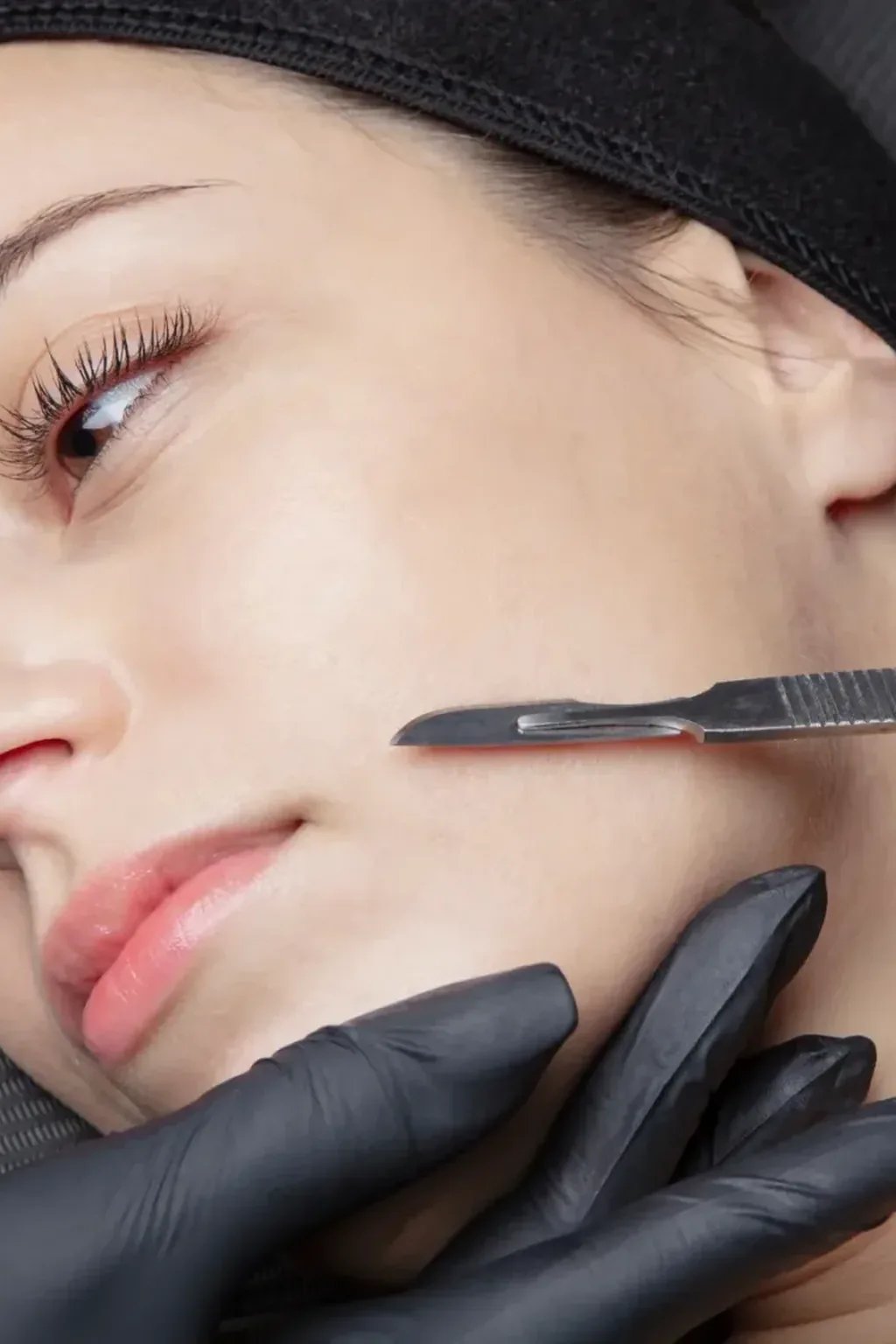 Can estheticians do dermaplaning in Florida?