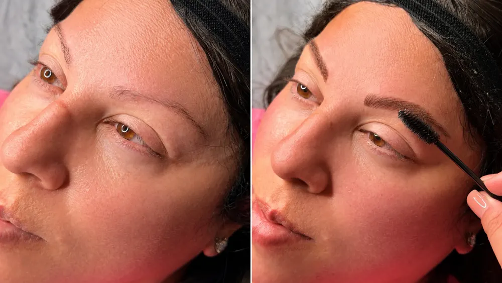 Before and after