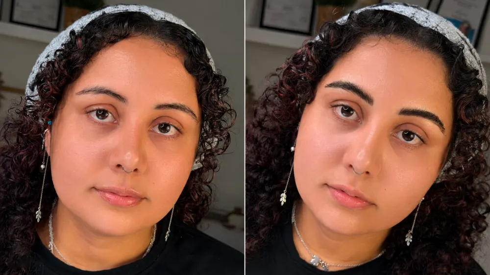 Before and after