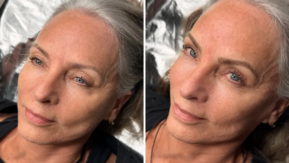 Before and after