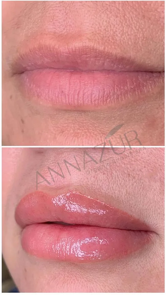 Lip Blush Permanent Before and after 3