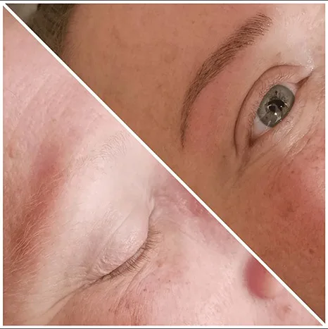 Microblading Before & After