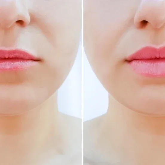 A before-and-after comparison of a woman's lips, illustrating the healed result of a permanent makeup artist's portfolio.