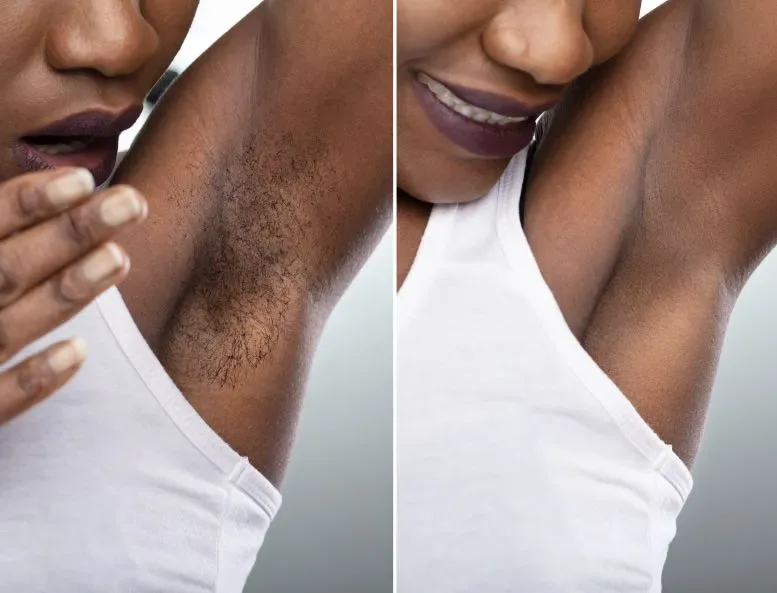 Before and after waxing at ANNAZUR Organic Beauty Spa, Jacksonville FL