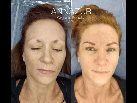 Before-and-after video of a Jacksonville microblading treatment